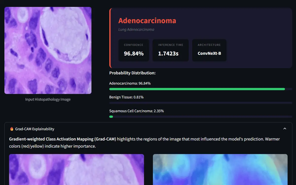 A histopathology slide beside its Grad-CAM heatmap, showing which tissue regions drove the classification